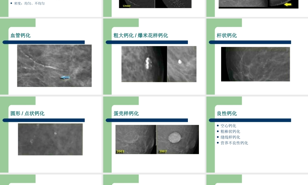 乳腺BI-RADS分级剖析.ppt