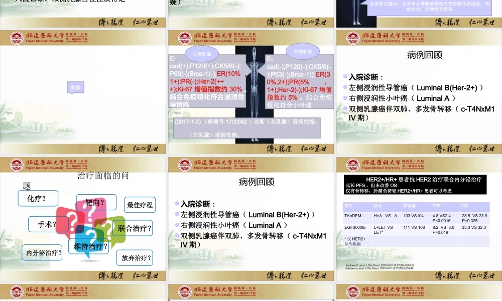 乳腺癌MDT讨论.ppt