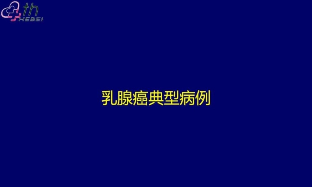 乳腺癌典型病例讨论一例..ppt