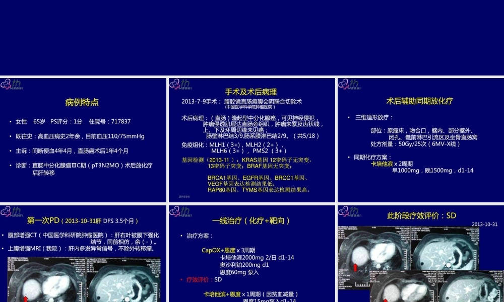 乳腺癌典型病例讨论一例..ppt