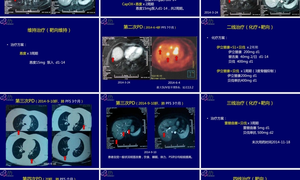 乳腺癌典型病例讨论一例..ppt