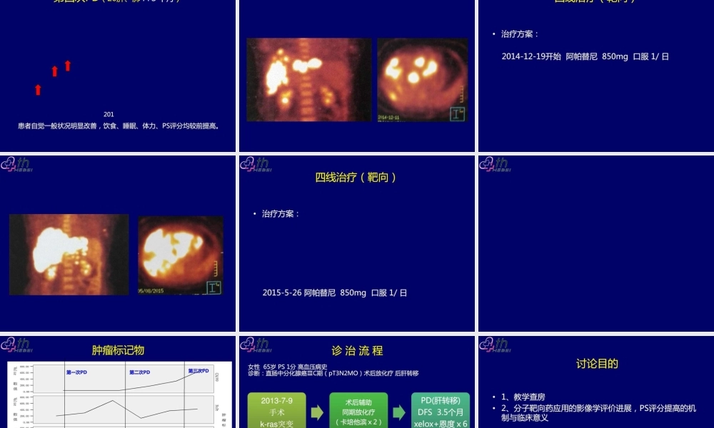 乳腺癌典型病例讨论一例..ppt