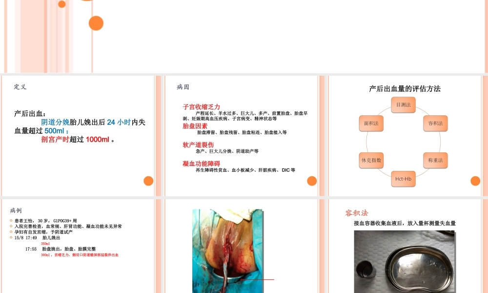 产后出血之出血量评估.ppt