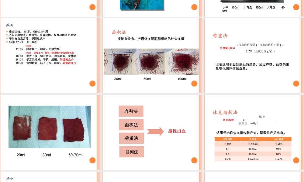 产后出血之出血量评估.ppt