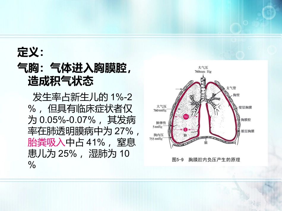 新生儿气胸.ppt_第3页