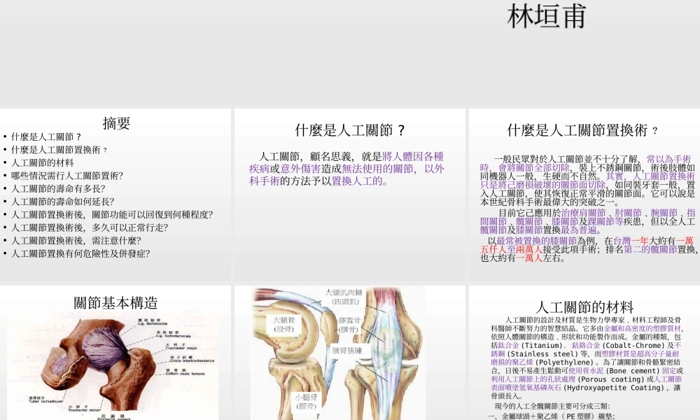 人工关节相关资料.ppt