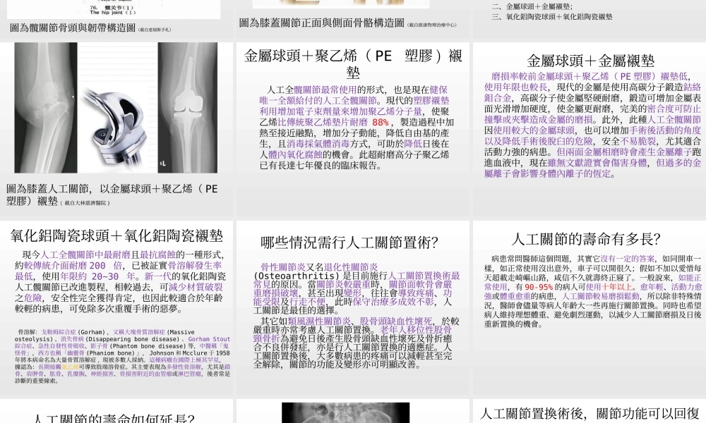 人工关节相关资料.ppt
