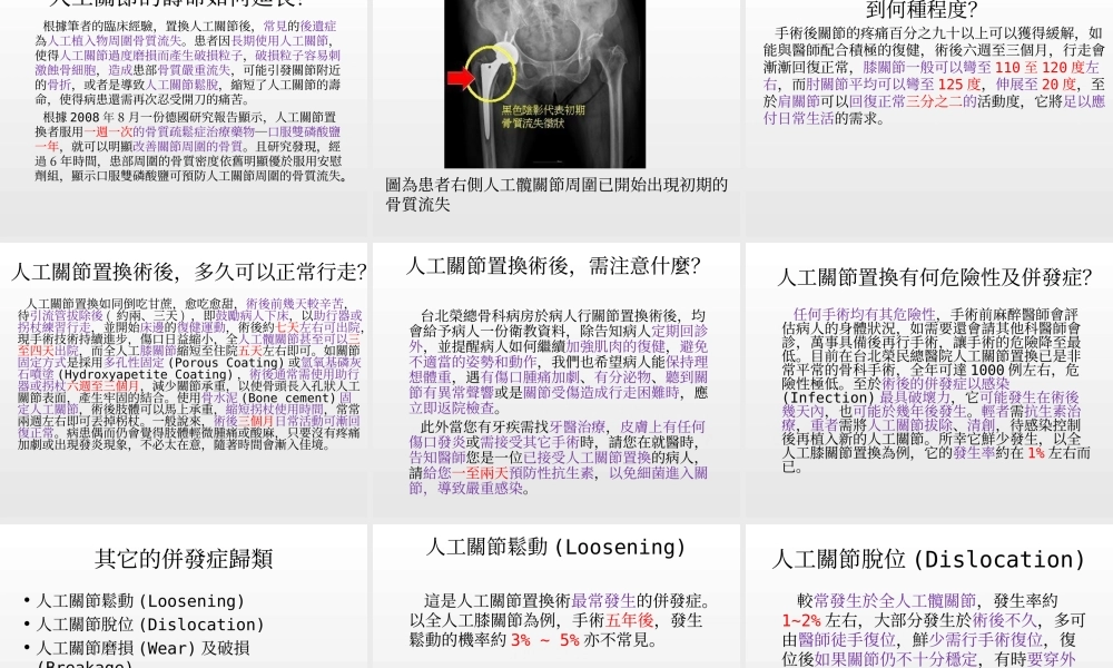 人工关节相关资料.ppt