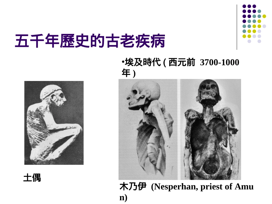 校园结核病防治.ppt_第3页