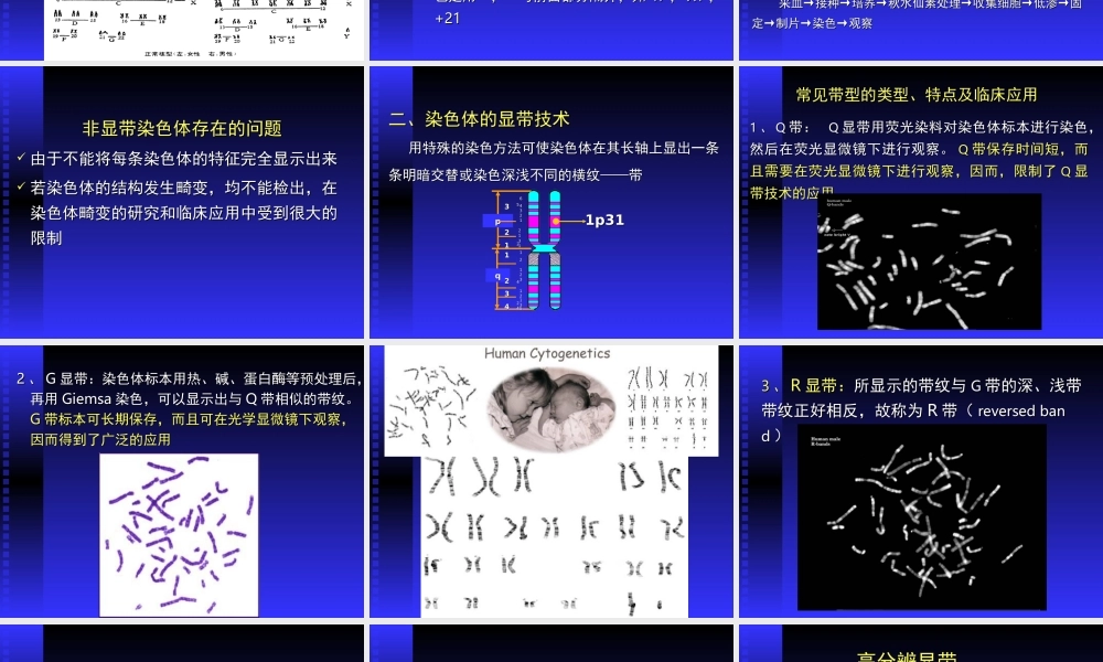 人染色体与染色体病.ppt