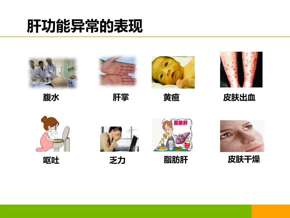 新版肝功能指标解读.pptx_第2页