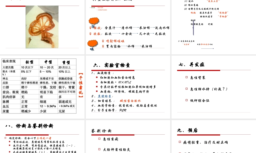 传染病学--霍乱.ppt