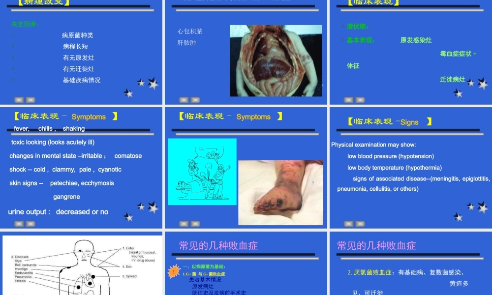 传染病学-败血症.ppt