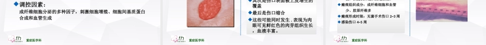 伤口愈合理论.ppt