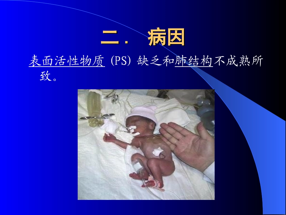 新生儿呼吸窘迫综合征-陈炎.ppt_第3页