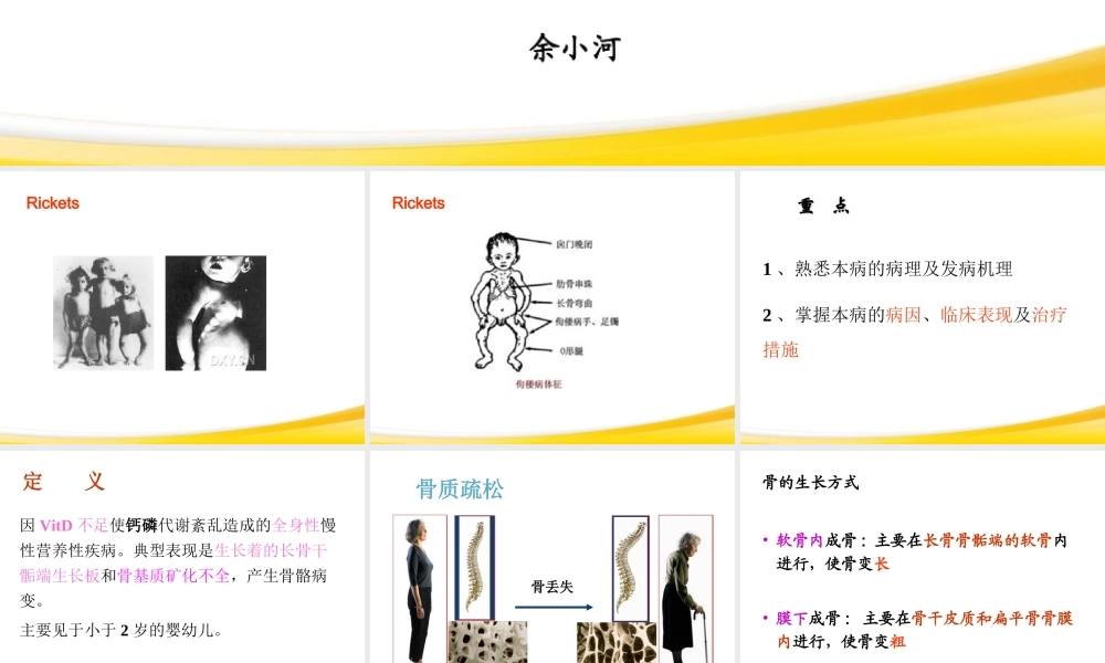 佝偻病与手足搐搦2013.ppt