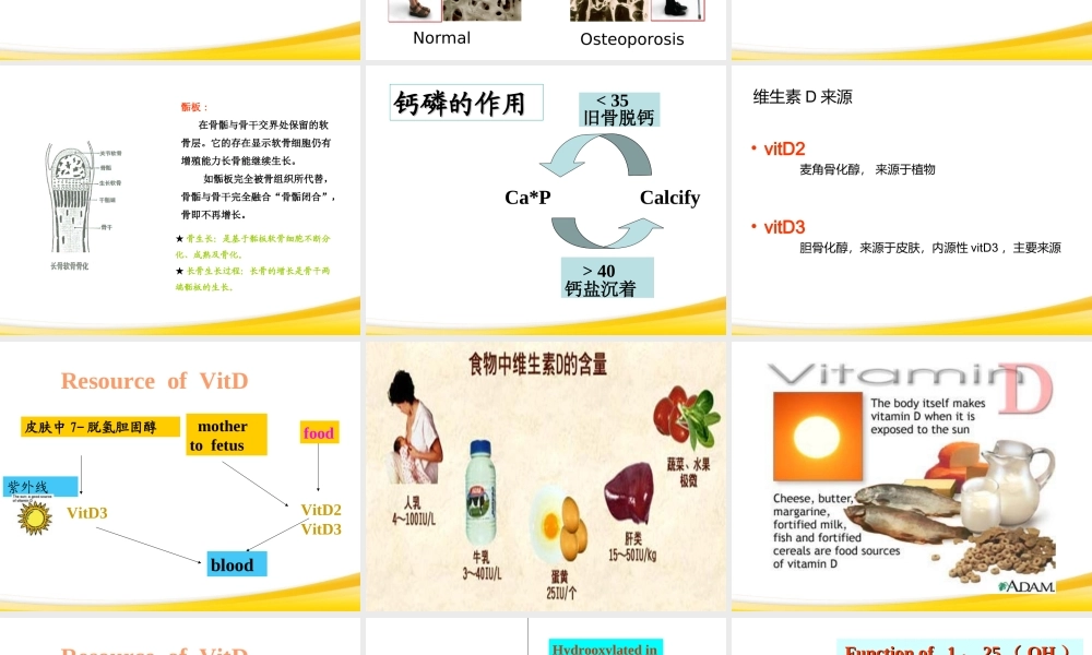 佝偻病与手足搐搦2013.ppt