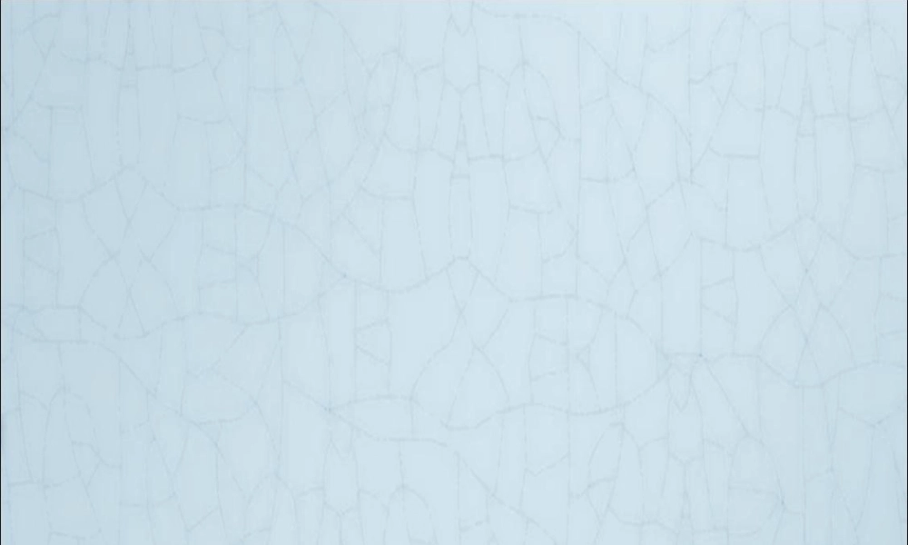 产后出血诊疗指南..ppt