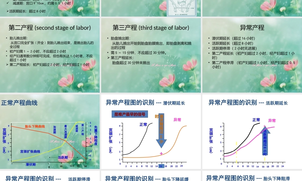 产程疼痛机制.pptx