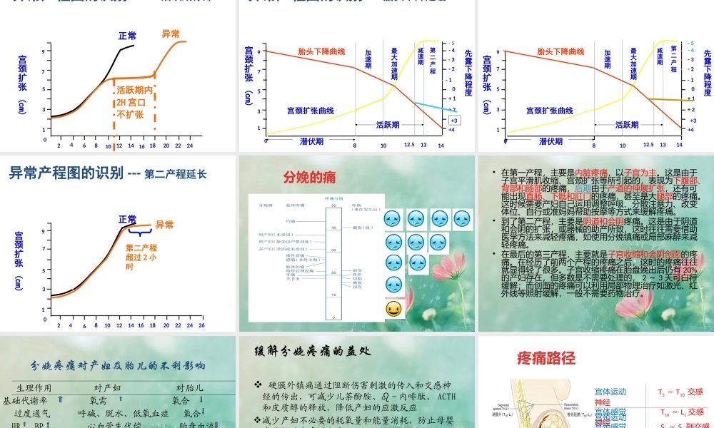 产程疼痛机制.pptx