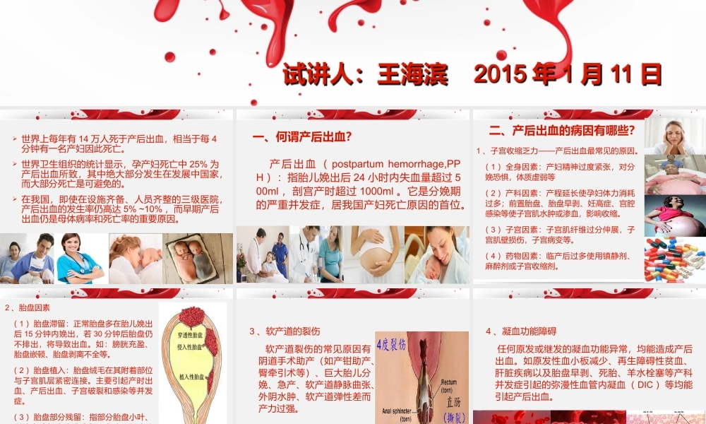 产后出血教学版.ppt