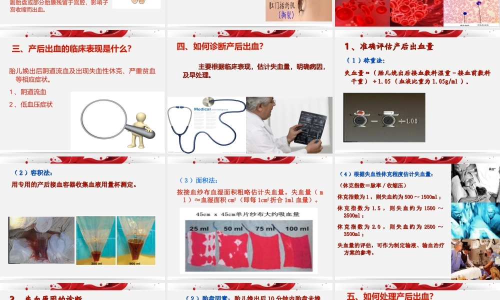 产后出血教学版.ppt