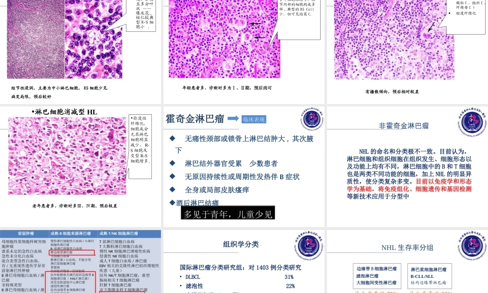 人卫三版-七八年制-淋巴瘤.ppt