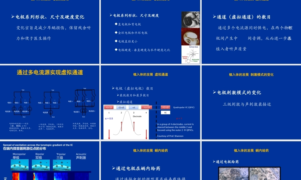 人工耳蜗技术及行业发展.pptx