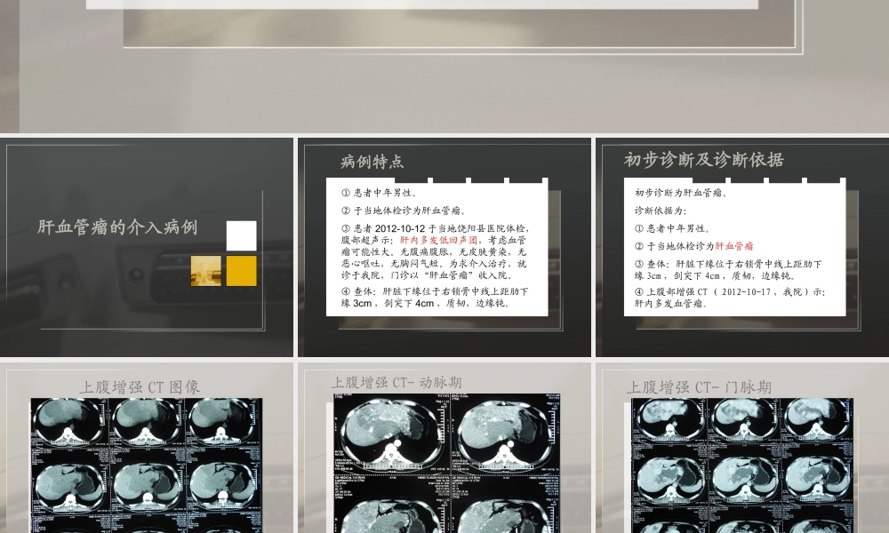 介入病房典型病例.ppt