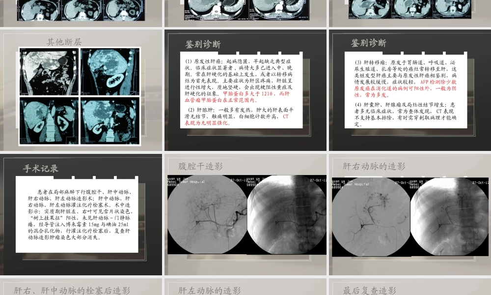 介入病房典型病例.ppt