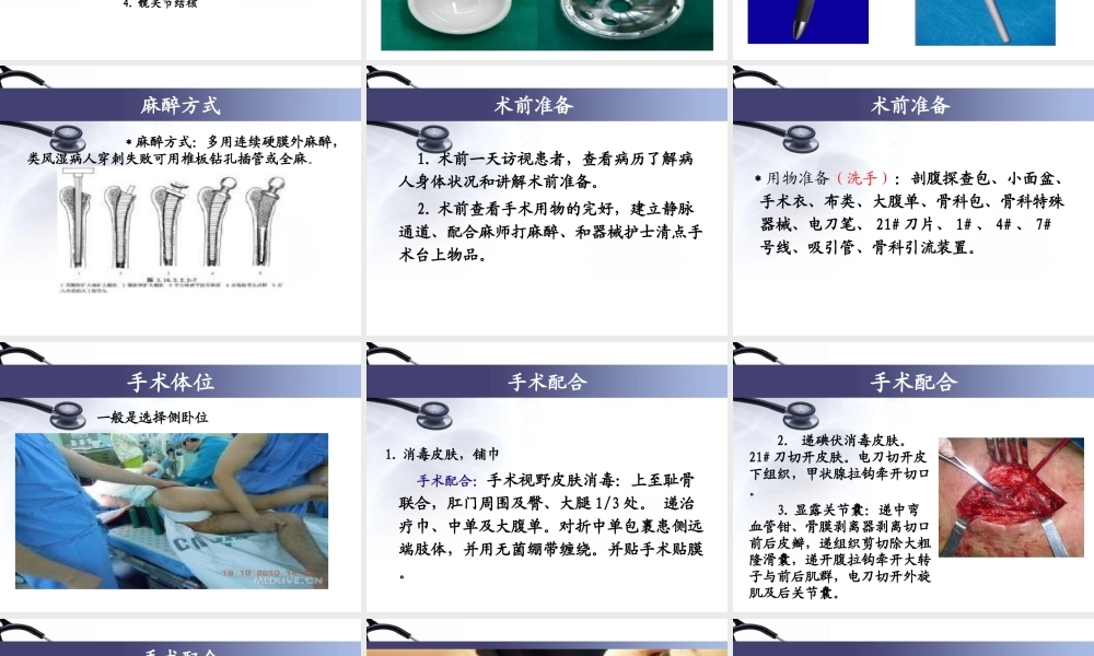 人工全髋关节置换术.ppt