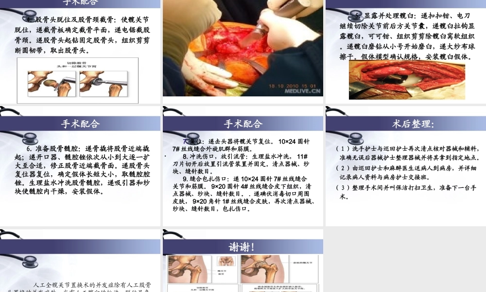 人工全髋关节置换术.ppt