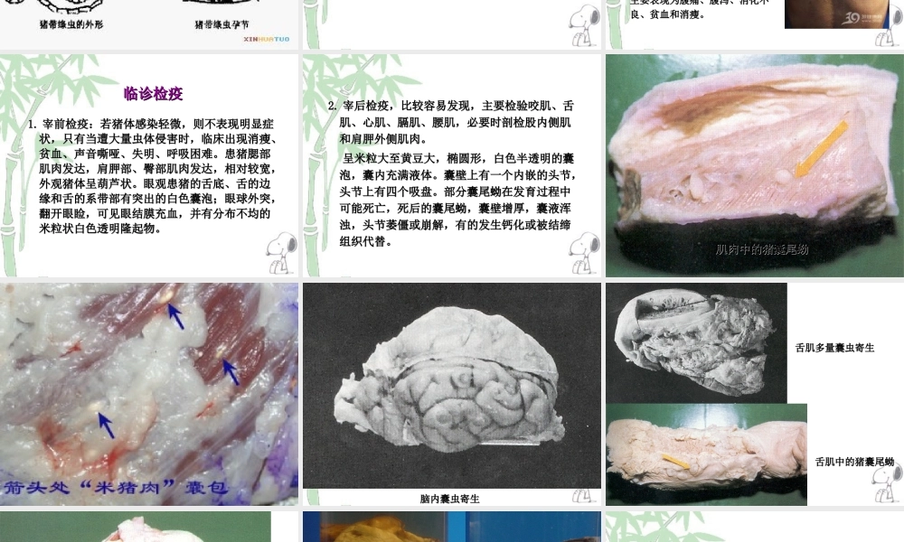 人畜共患寄生虫病的检疫.ppt