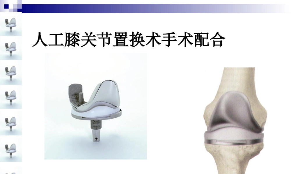 人工膝关节置换术手术配合ppt..ppt
