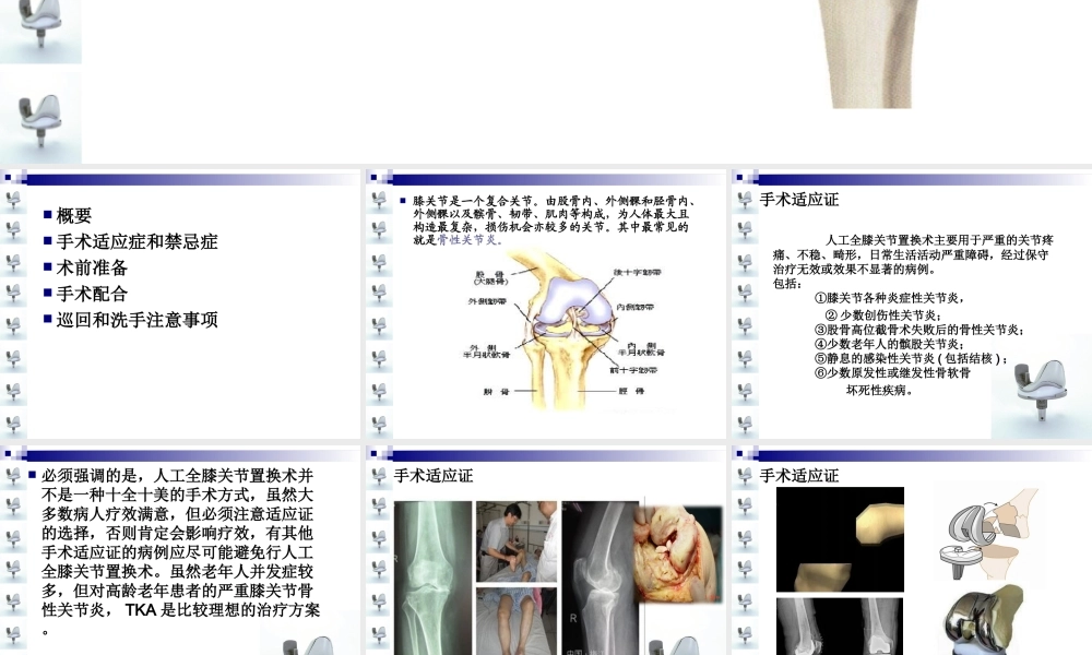 人工膝关节置换术手术配合ppt..ppt