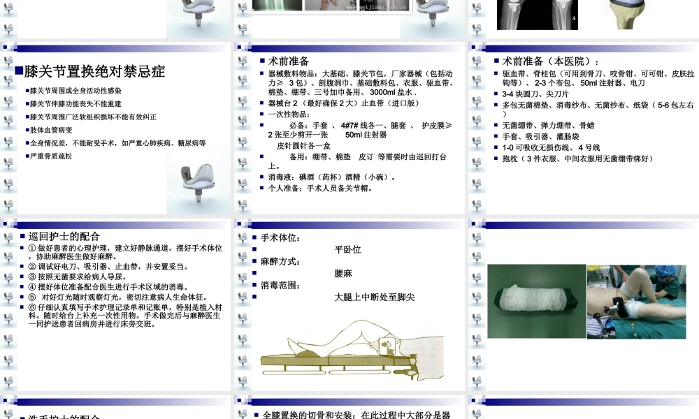 人工膝关节置换术手术配合ppt..ppt