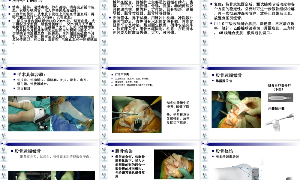人工膝关节置换术手术配合ppt..ppt