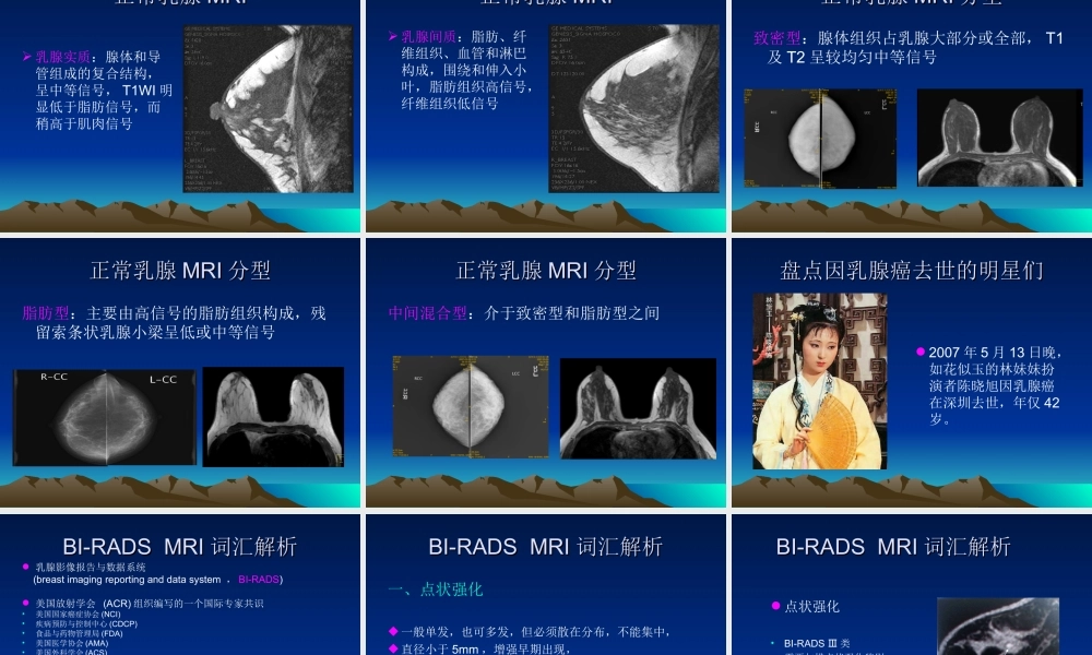 乳腺病变磁共振检.ppt