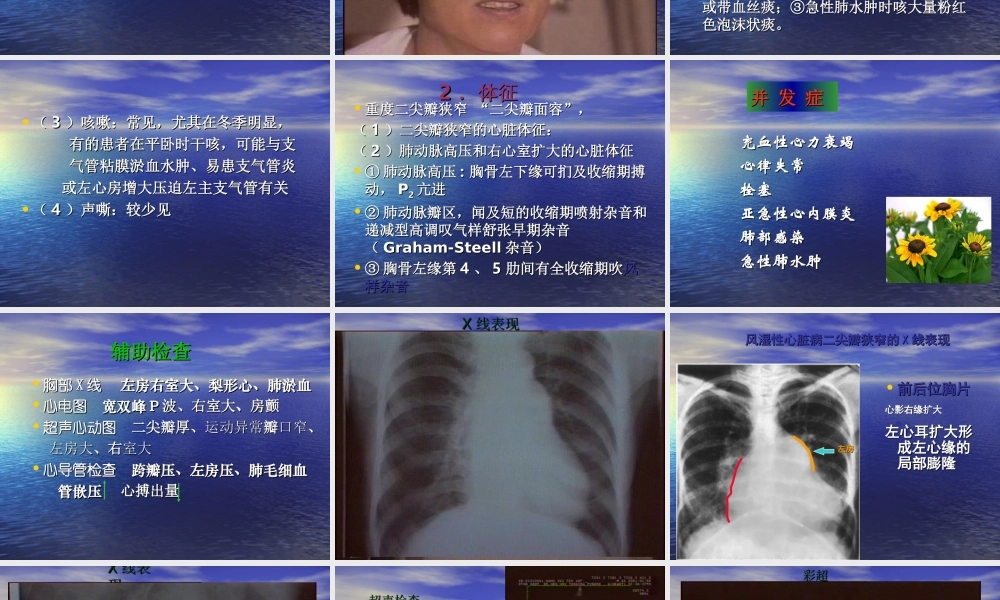 二尖瓣狭窄的心脏体征.ppt