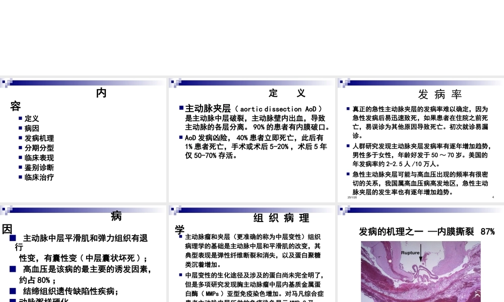 主动脉夹层.jsp.ppt