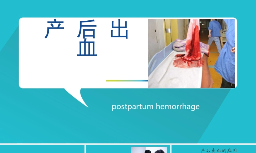 产-后-出-血.pptx