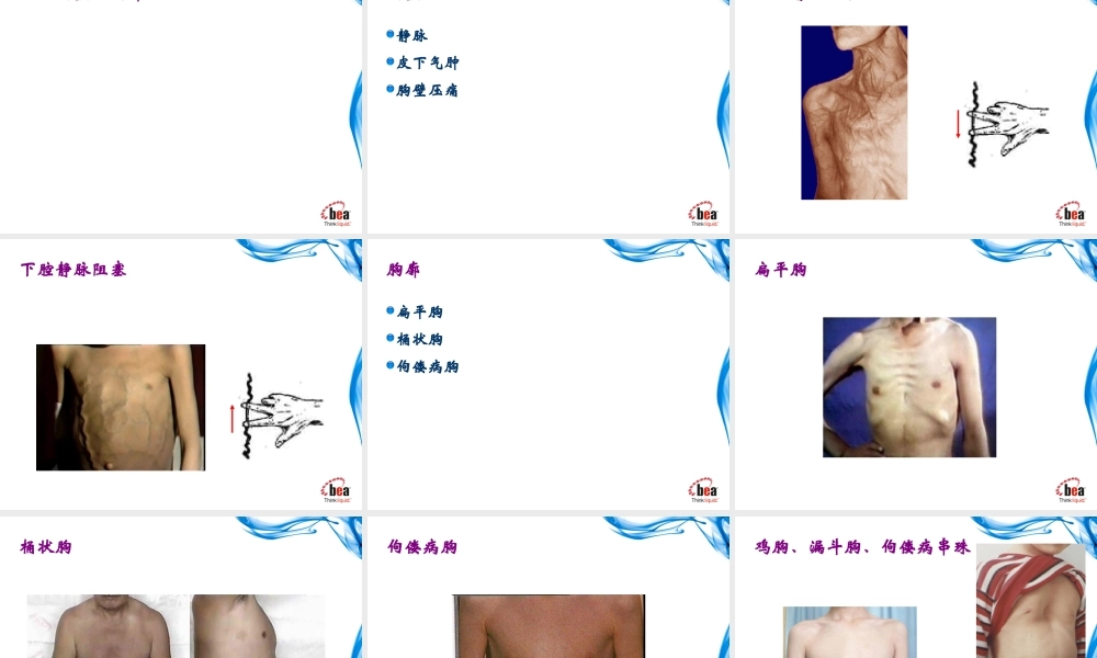 健康评估-胸部检查(理论).ppt