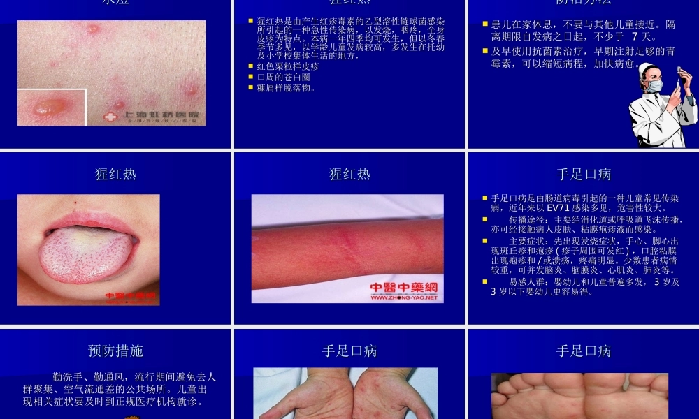 儿科常见传染病的防治.ppt