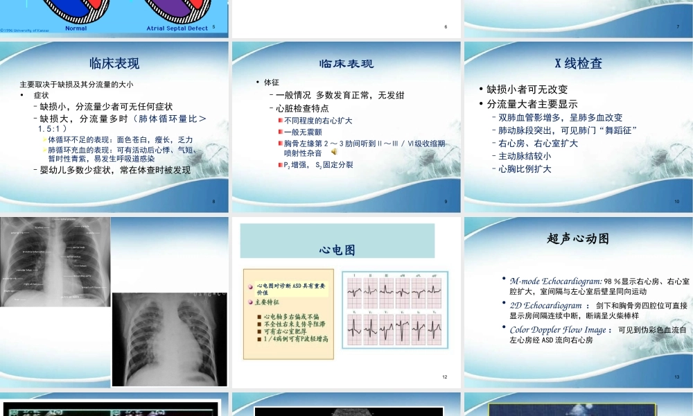 儿童先天性心脏病.ppt