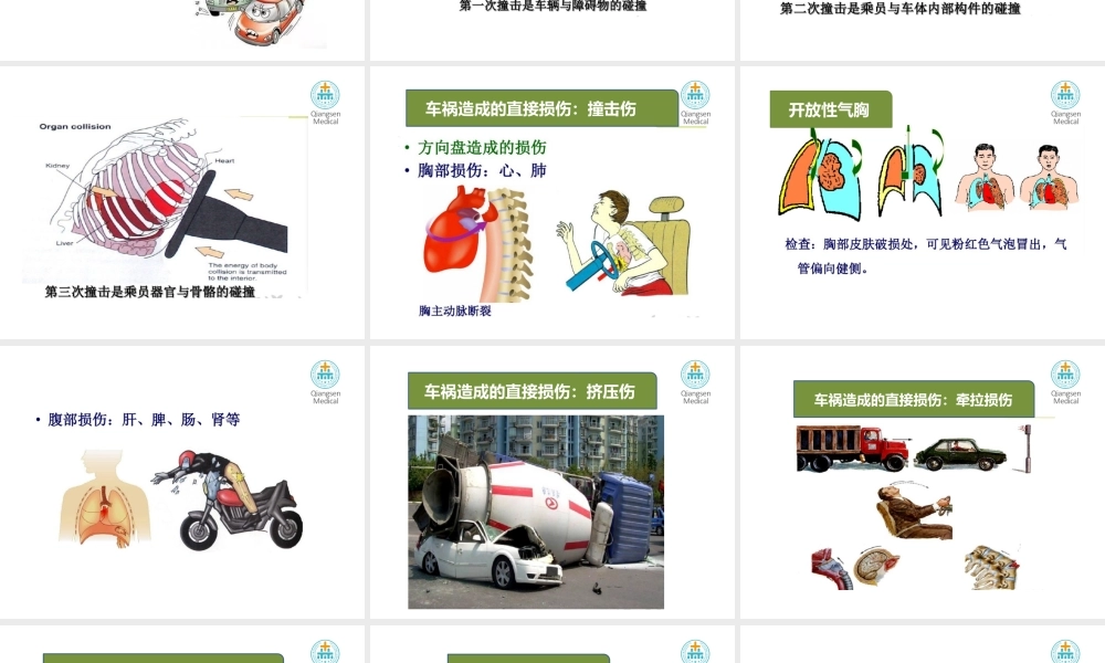 儿童意外伤害及急救(1).pptx