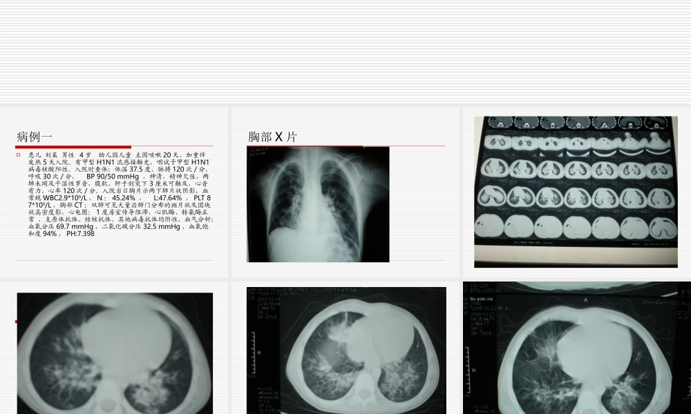 儿童甲型H1N1重症诊治探讨.ppt