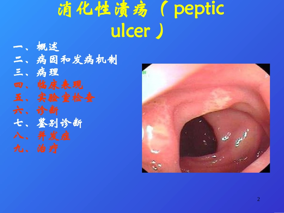 消化性溃疡08905.ppt_第2页
