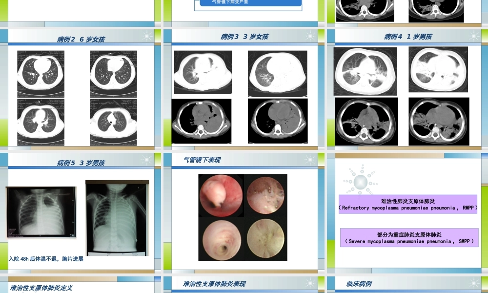 儿童难治性支原体肺炎的诊治.ppt