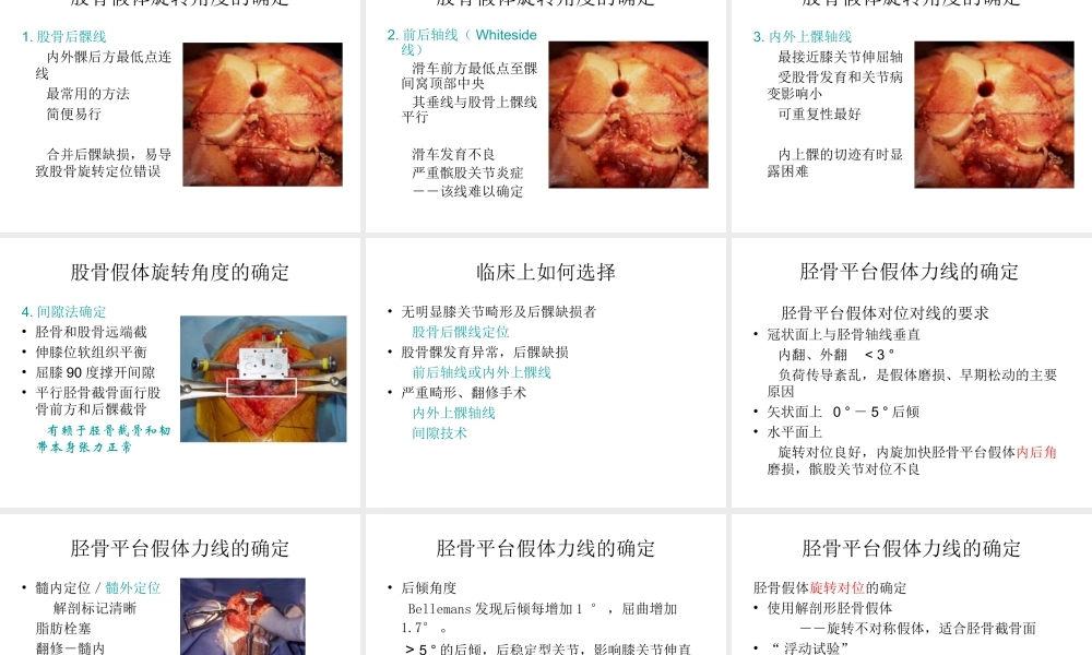 全膝关节置换术力线.ppt