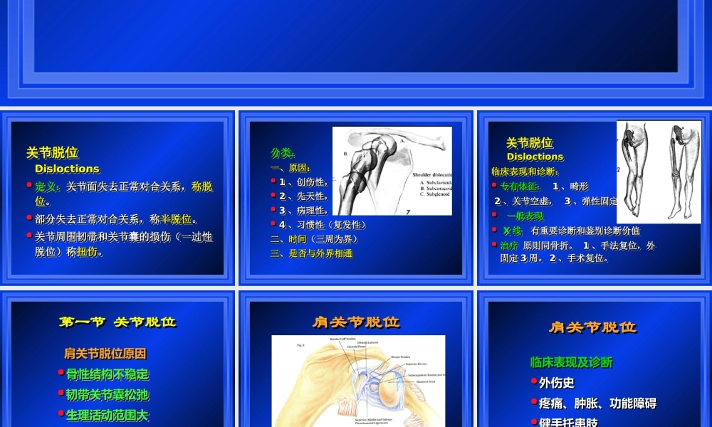 关节损伤.ppt